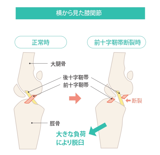 前十字靭帯断裂 症例紹介 苅谷動物病院グループ 東京 市川市に5つの病院を展開 年中無休